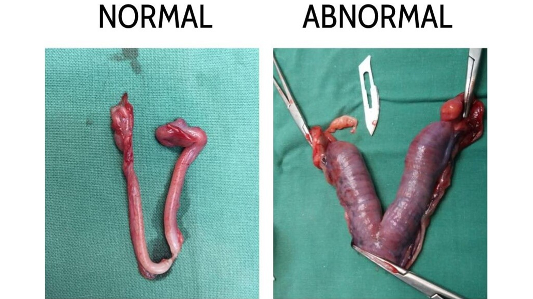 pyometra